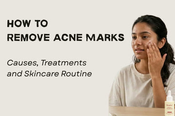 How to Remove Acne Marks: Causes, Treatments and Skincare Routine