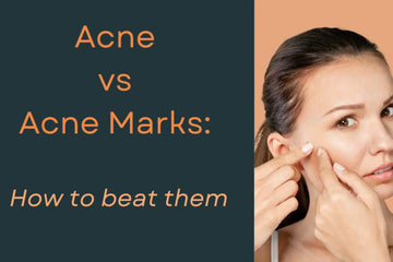 Acne vs Acne Marks: What’s the Difference and How to Treat Both